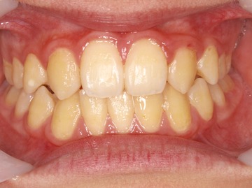 ケースNo.1 治療後 (1).jpg